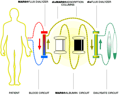 The Molecular Adsorbent Recirculating System (MARS) - Image courtesy of Gambro Hong Kong Limited