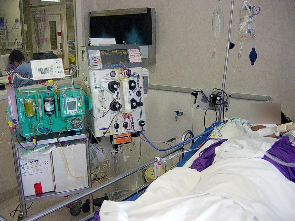 Fig. A patient on MARS in Queen Mary Hospital, Hong Kong